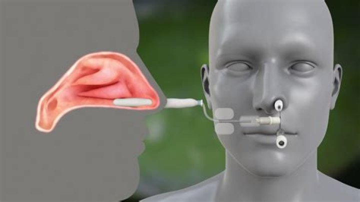 How long does Rhino line last