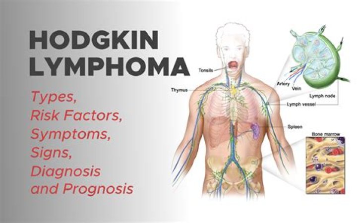 What does Hodgkins lymphoma mean