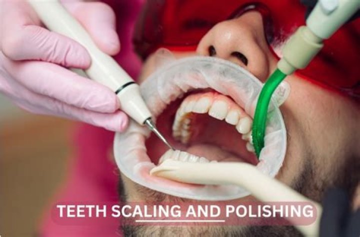 What does polishing your teeth do