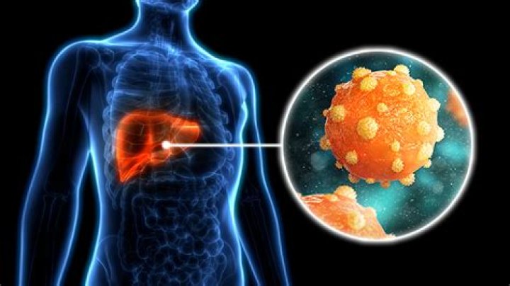 What type of virus is hepatitis B