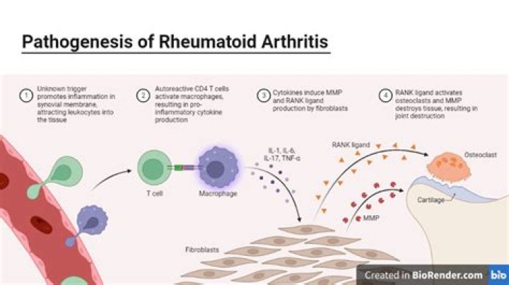 Why do you get reactive arthritis